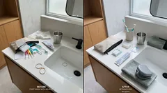 What to expect when you get braces in the Philippines, from first day to removal