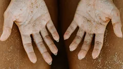 Reveal your most radiant Pinay skin with these tried-and-true acne spot solutions